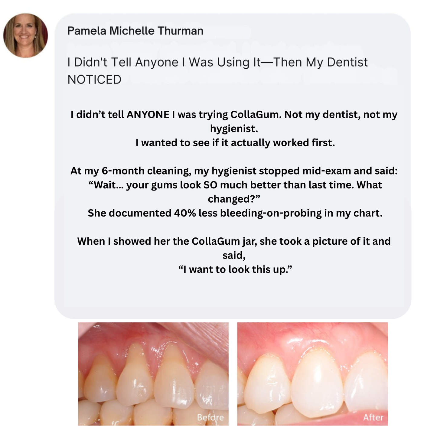 Nudent Gingival Maritime Collagen & Zinc Citrate - Natural Gum Support