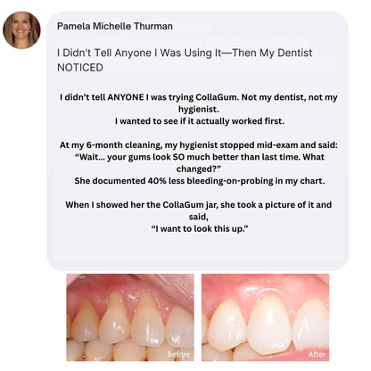 Nudent Gingival Maritime Collagen & Zinc Citrate - Natural Gum Support