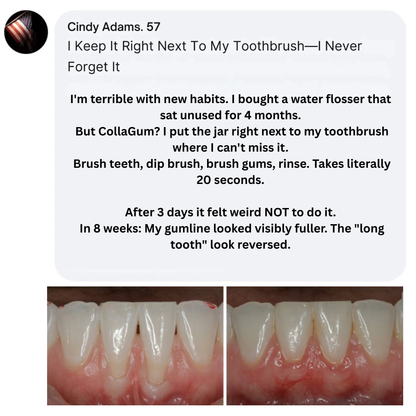 Nudent Gingival Maritime Collagen & Zinc Citrate - Natural Gum Support