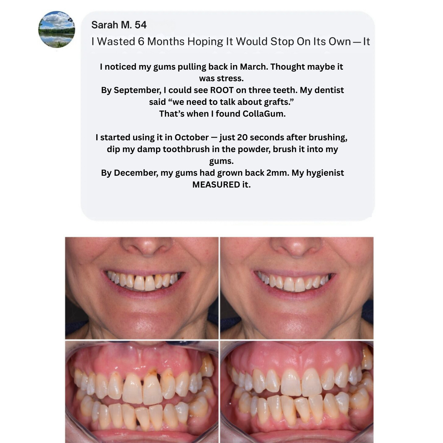 Nudent Gingival Maritime Collagen & Zinc Citrate - Natural Gum Support